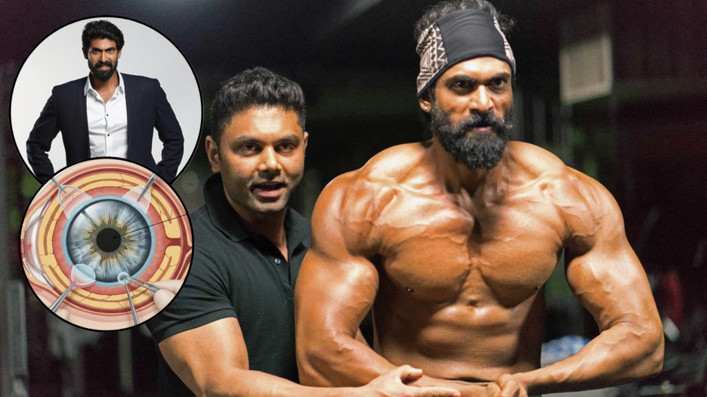 Rana Daggubati corneal transplant