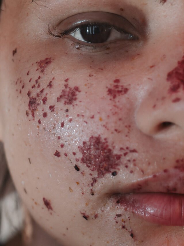 ड्राई स्किन के लिए 10 असरदार घरेलू उपाय | Dry Skin Home Remedies